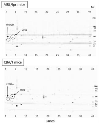 A Selective Neutraligand for CXCL12/SDF-1α With Beneficial Regulatory Functions in MRL/Lpr Lupus Prone Mice